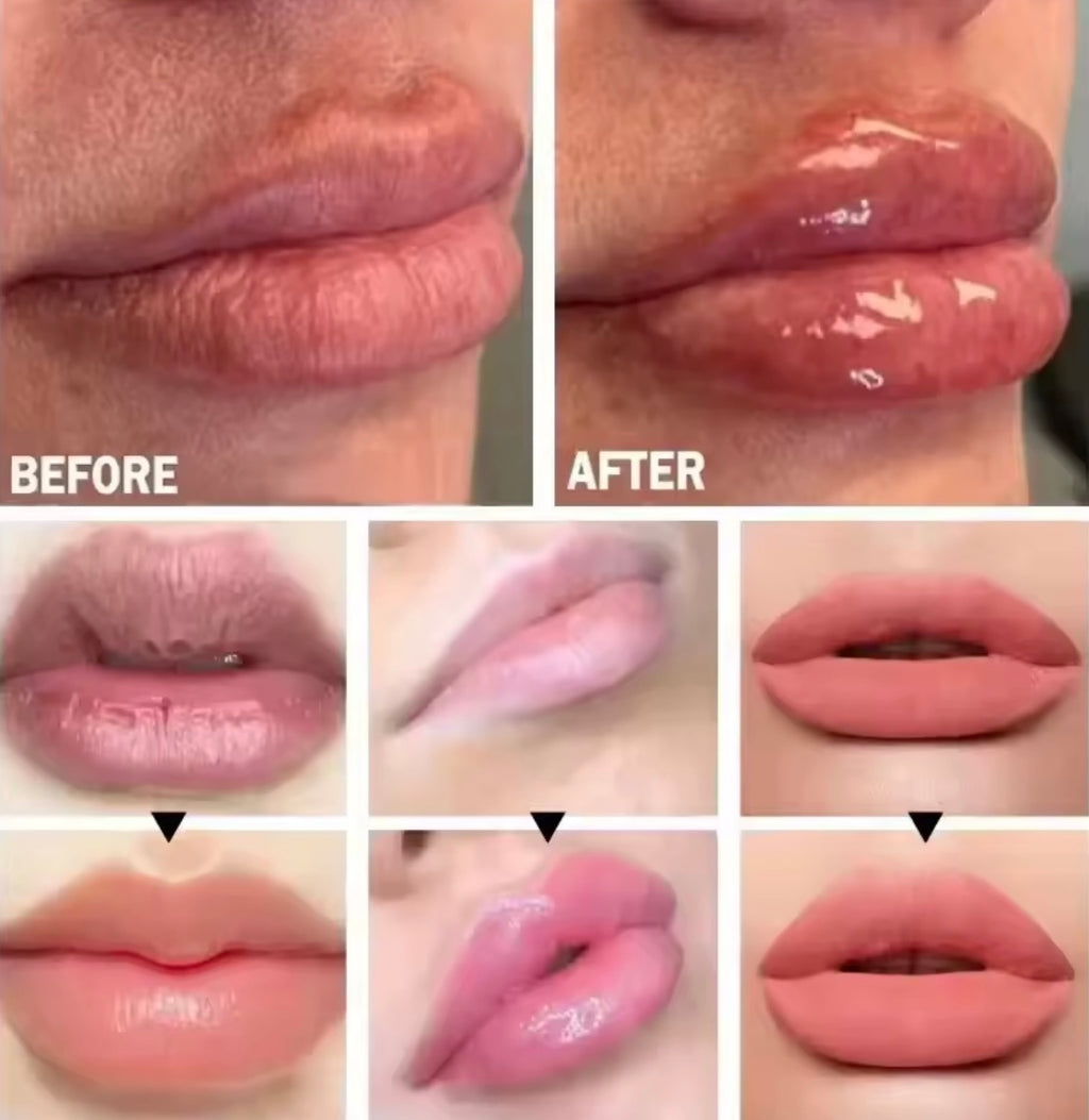 Carvenchy BP Spicule Lip Plumping Lip Shot